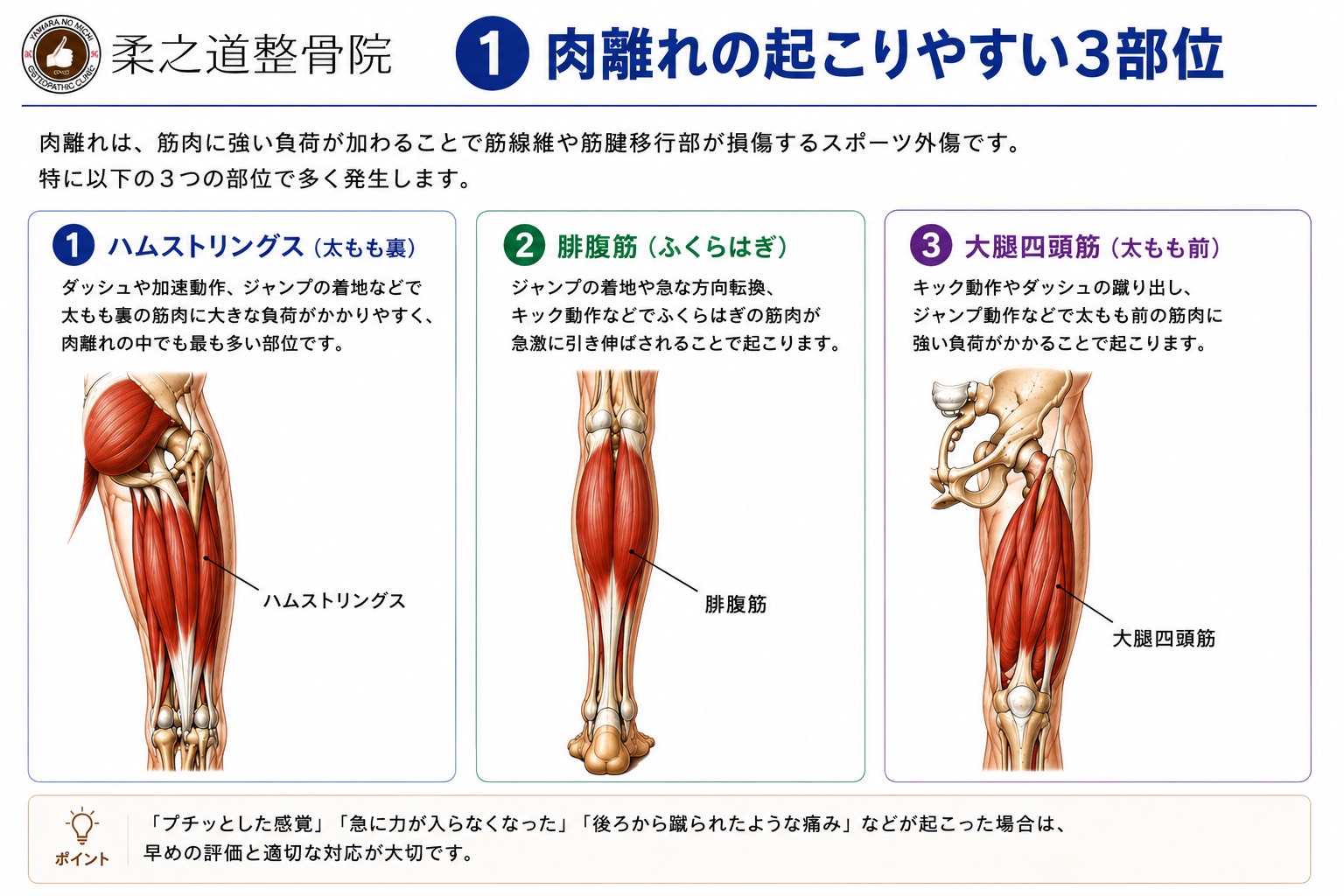 肉離れの起こりやすい3部位